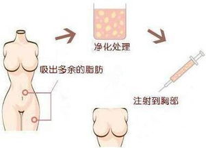 乌鲁木齐微整形培训 微整型学习学校