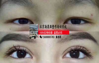 微整形培训学校郑州十大排行-培训通