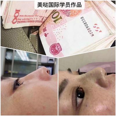 山东微整形培训学校哪家正规专业