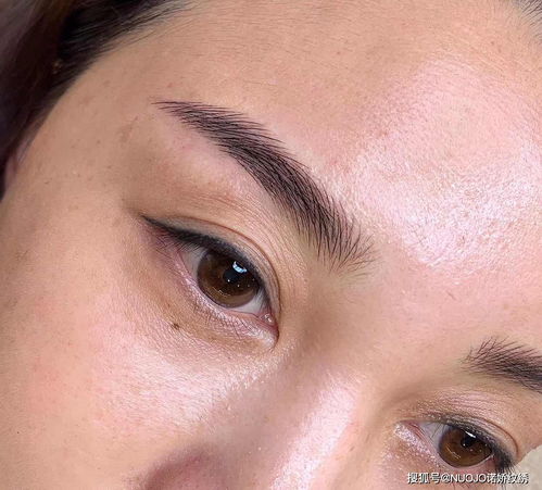 顾客右边眼皮肌无力纹眉,我选择操作机器线条眉来遮盖