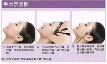 清远赴韩微整形培训学校,免费进修。