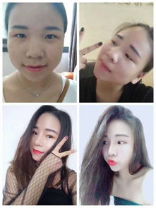 漯河微整形培训学校哪一家好