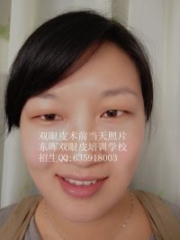 .东晖微整培训学校为你解答各种整形术后恢_商务服务_世界工厂网