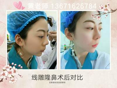 湖北哪里有微整形培训学校
