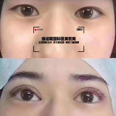 甘肃微整形培训学校指南